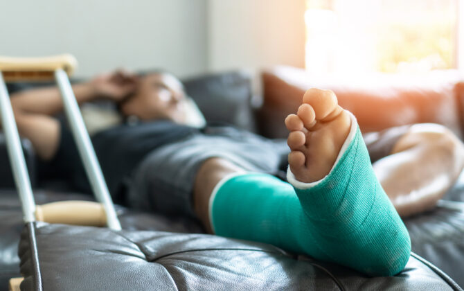 Bone fracture foot and leg on male patient with splint cast and crutches during surgery rehabilitation and orthopaedic recovery staying at home